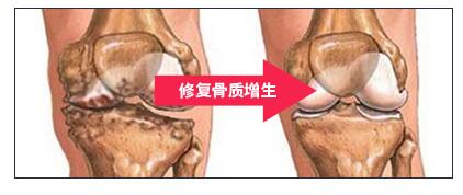 服用葡萄糖胺的作用與功效